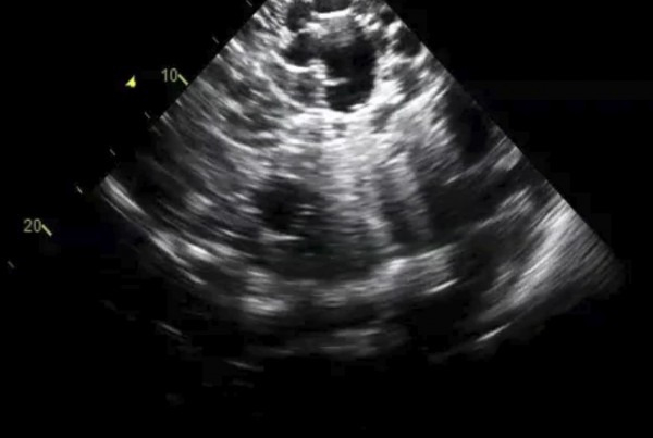 Masters in Ultrasonography