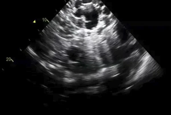 Masters in Ultrasonography